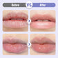 👄Sérum hydratant pour les lèvres repulpant et anti-rides👄